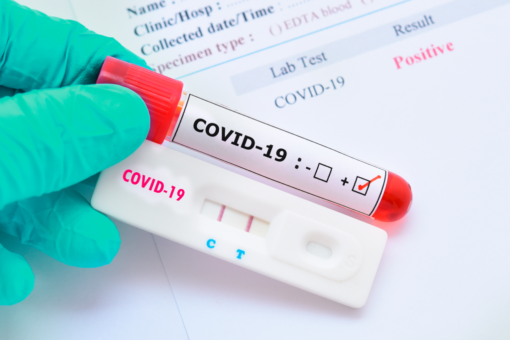 Vilhena registrou 25 novos casos de Covid-19 neste domingo; números da testagem em massa serão incluídos no boletim desta segunda
